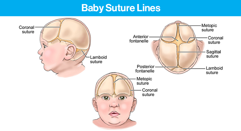 Baby Suture Lines